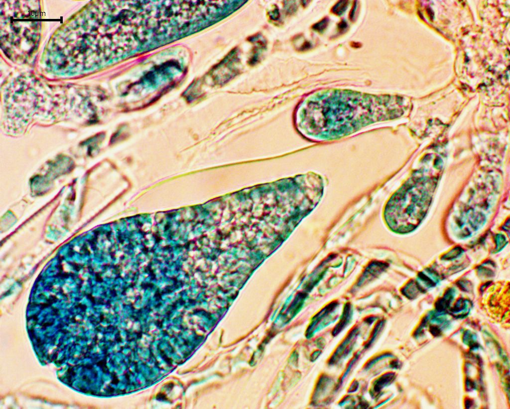 A liberating carpospore.