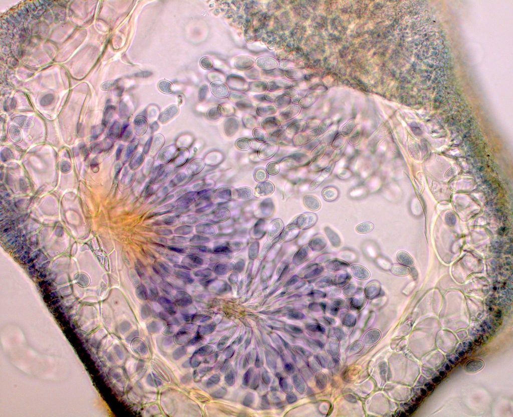 Cross-section of Lemanea fluviatilis