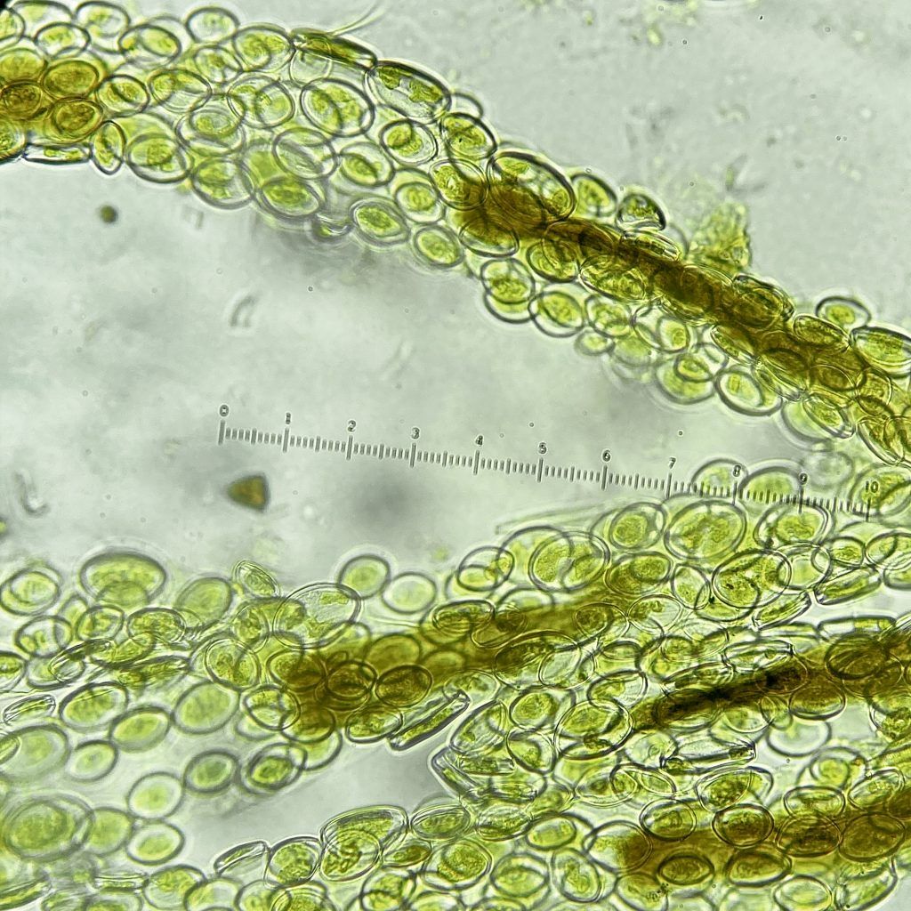 Crowded Cocconeis sp.