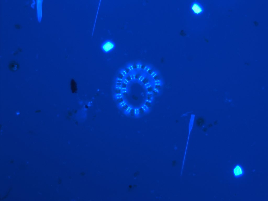 One bright moment is all I ask