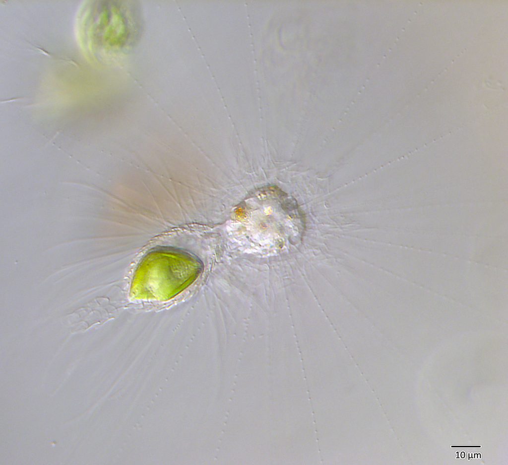Actinophrys vs Mallomonas caudata