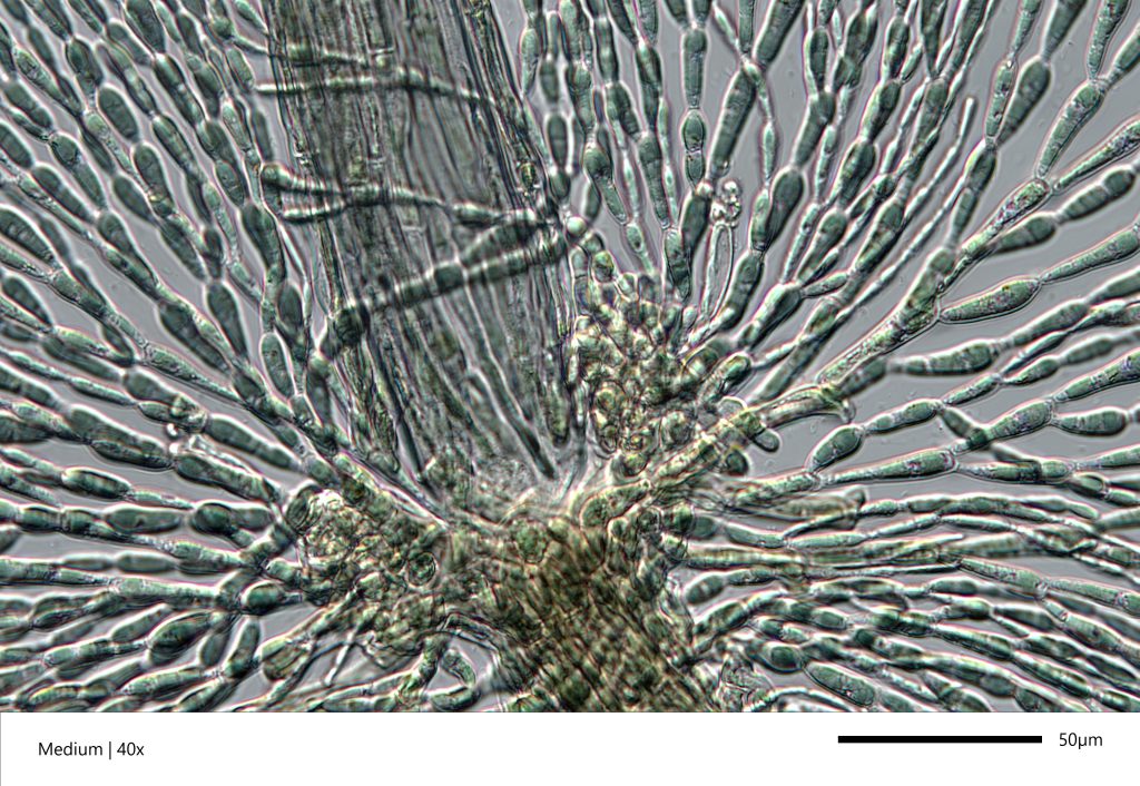 Batrachospermum-"The hidden Trichogyne"