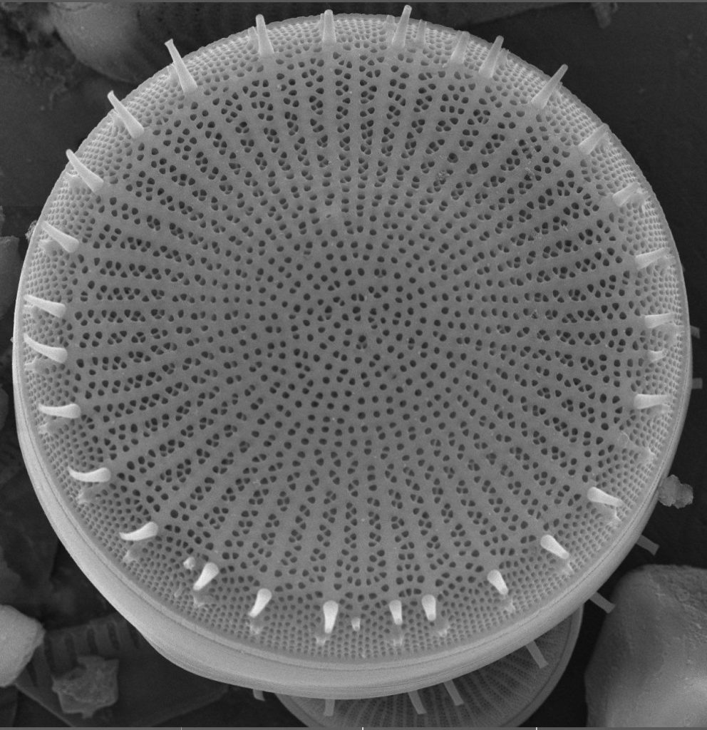 Diatoms in Nature's Gallery - Stephanodiscus niagarae