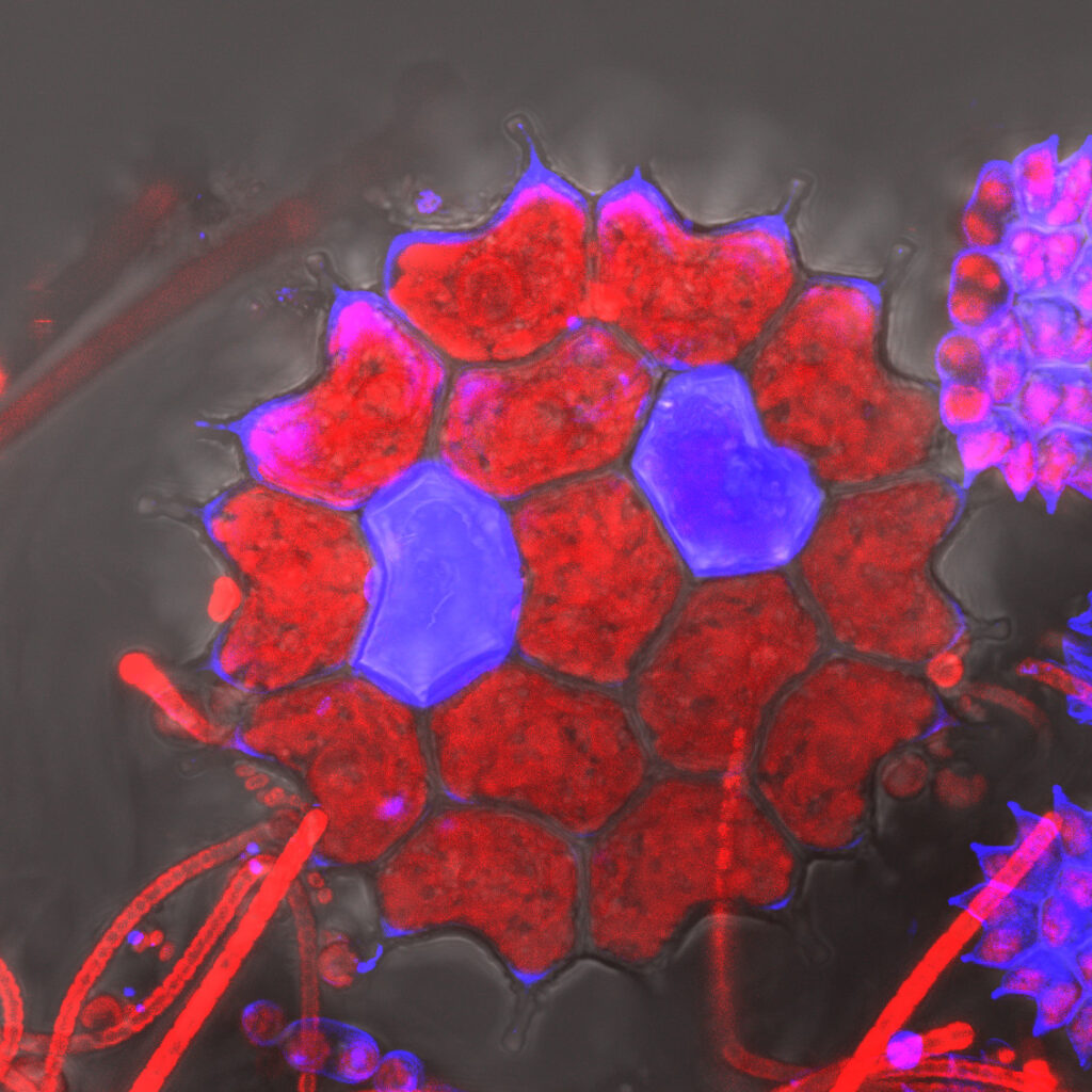 Symphony of Symmetry – The Geometric Grace of Pediastrum