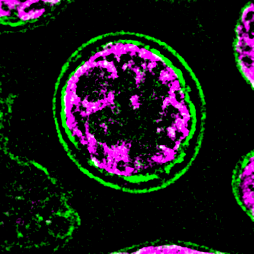 Metamorphosis of a unicellular green alga: Discovery of a double-layered cell wall