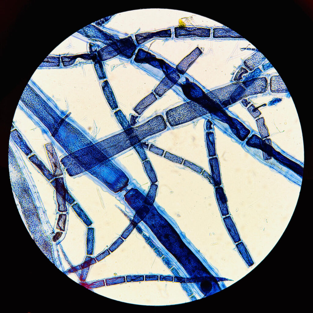 Deep Pit Connections