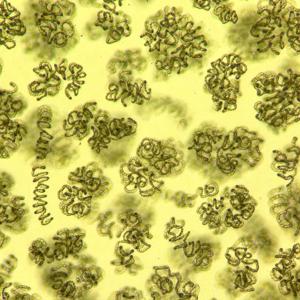 Dancing Dolichospermum